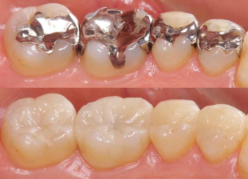 美しさだけではない、審美歯科の目的|まきの歯科