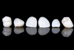 セラミック治療｜まきの歯科