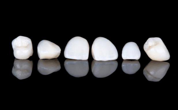 セラミック治療｜まきの歯科