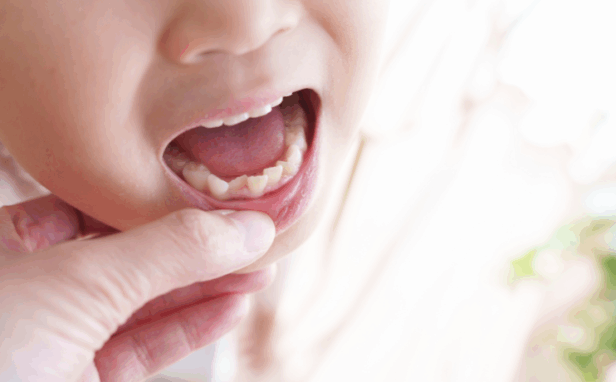 矯正のタイミング｜まきの歯科