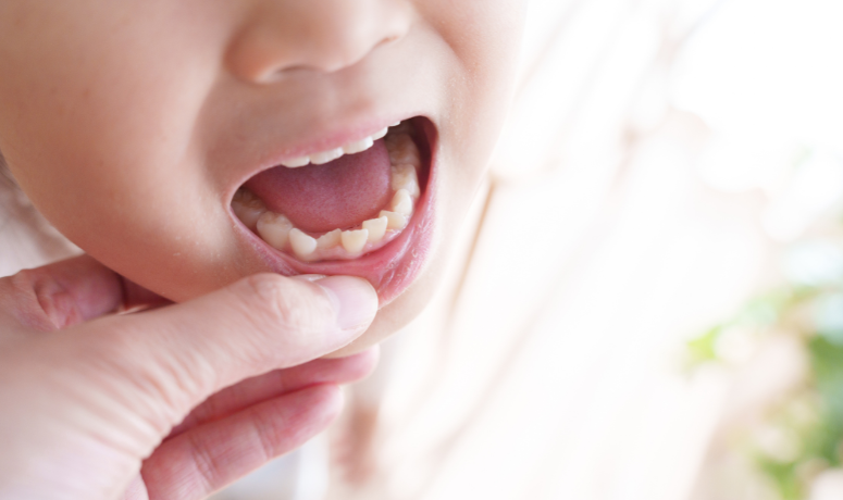 矯正のタイミング｜まきの歯科