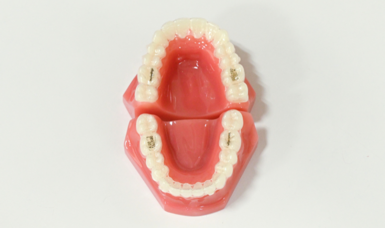 インビザライン｜まきの歯科