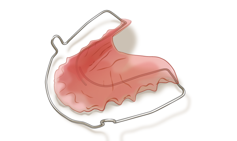 リテーナー｜まきの歯科