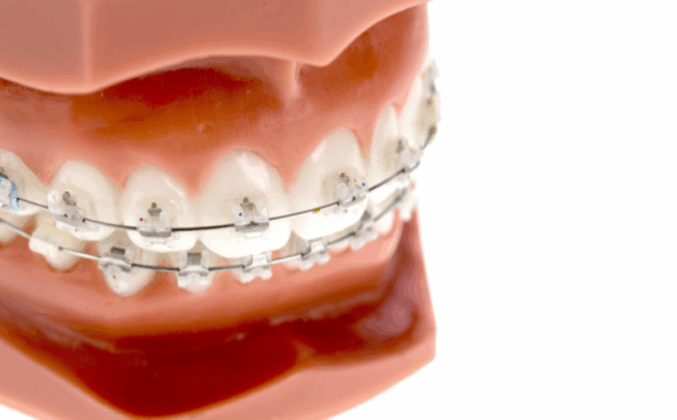 成人矯正治療｜まきの歯科