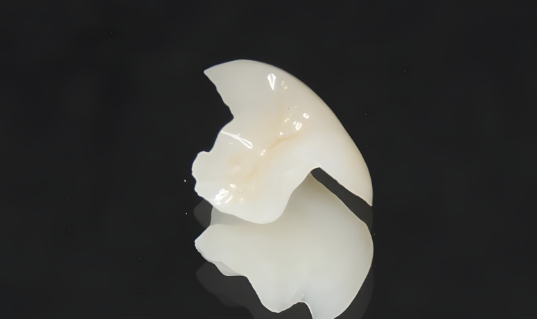 見た目に配慮した仕上がり｜まきの歯科