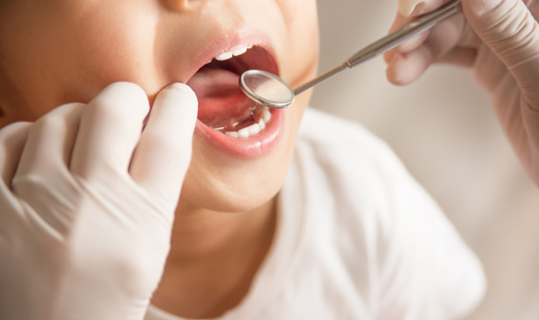 お子様にも優しい虫歯治療｜まきの歯科