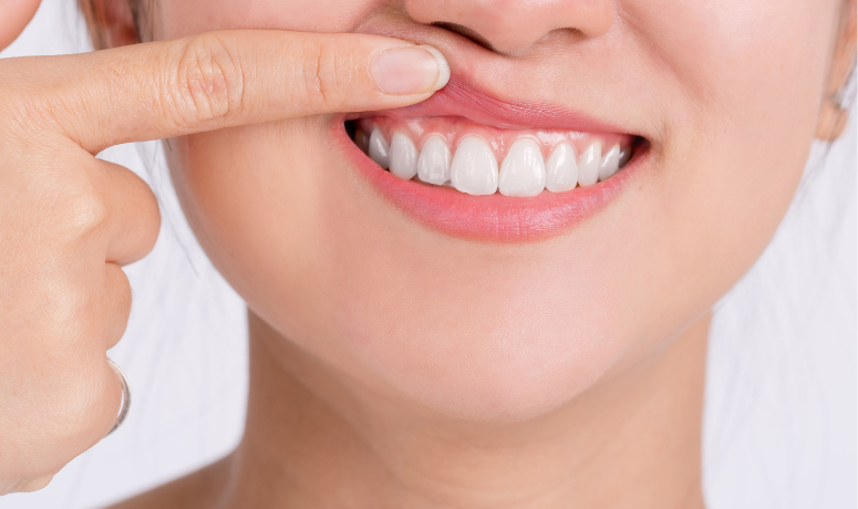 口腔トラブルが少ない｜まきの歯科