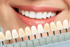 噛み合わせ治療・顎関節症