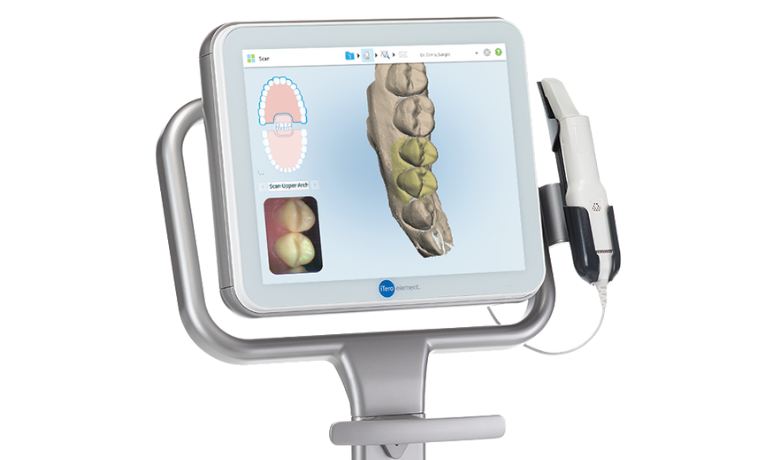 iTero｜まきの歯科