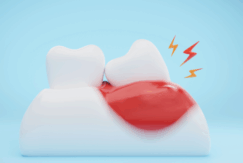 歯周病｜まきの歯科