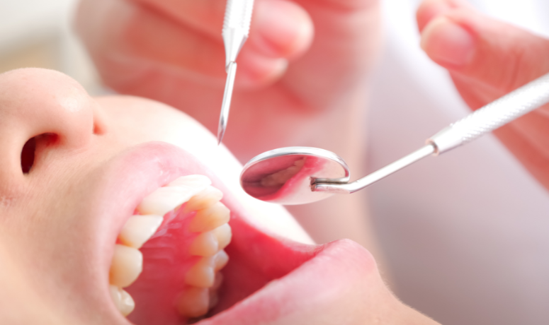 歯科衛生士によるサポート|まきの歯科